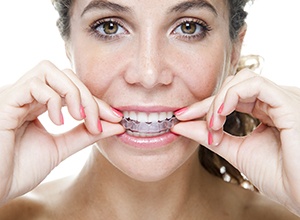 Woman placing Invisalign tray