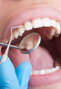 dentist performing checkup and cleaning on patient 