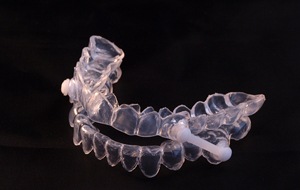 oral appliance for sleep apnea