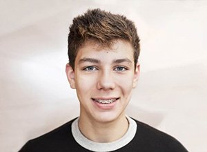 Smiling teen boy in black t-shirt, wearing orthodontic braces