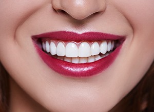 Close-up of woman’s perfect smile with veneers in Enfield