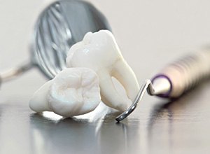 Close-up of two extracted wisdom teeth