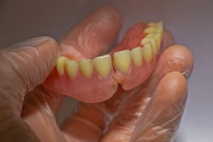 Gloved hand holding broken dentures that need to be replaced