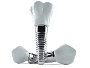 Three dental implants with crowns pictured against white background 