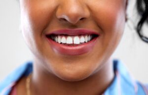 Close-up of woman’s smile with small gap between front teeth